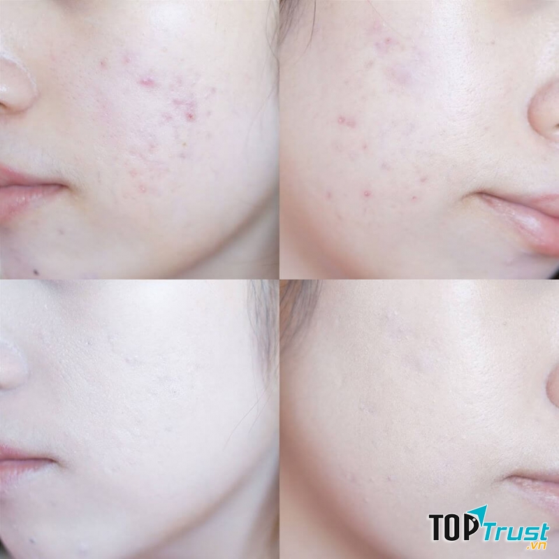 Che khuyết điểm Karadium Main Actress Cover có chất kem siêu mịn, khi apply cho cảm giác mượt mà, dễ tán đều, không còn cục.