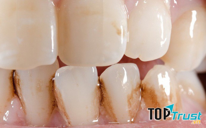 Ảnh minh họa - nguồn internet