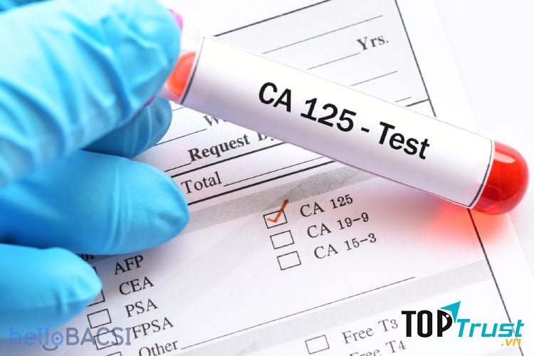 Xét nghiệm CA 125