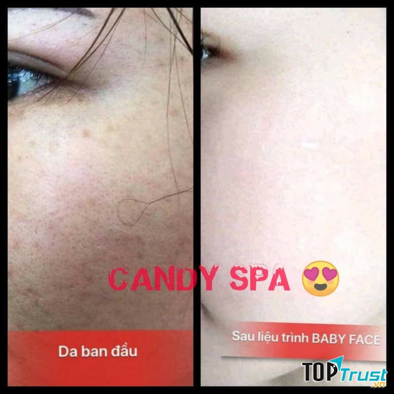 Candy Spa Quận 2