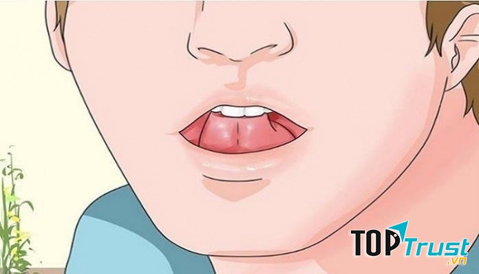 Chạm đầu lưỡi vào vòm miệng để bớt nhức đầu