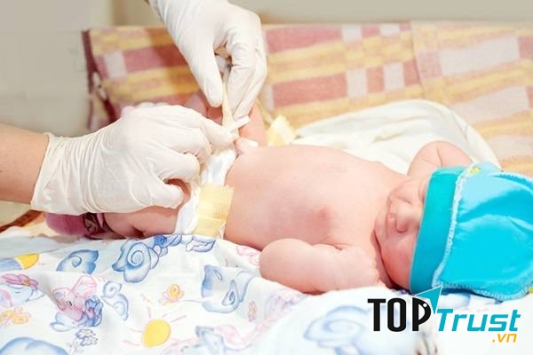 Chăm sóc rốn cẩn thận