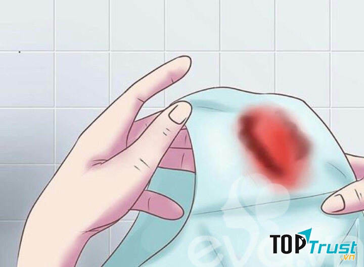 Tiểu ra máu, tiểu mủ