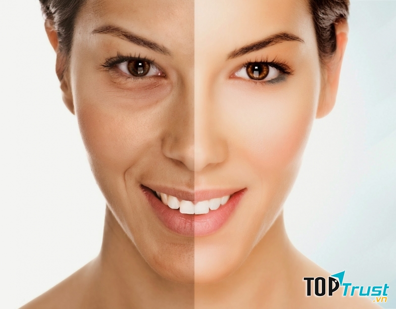 Chống lại một số tác nhân gây lão hoá hiệu quả nhất