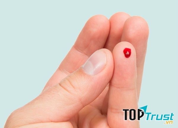 Hành tím giúp cầm máu nhanh