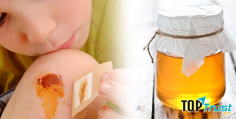 Mật ong có thể dùng làm thuốc bôi đối với những vết thương ngoài da