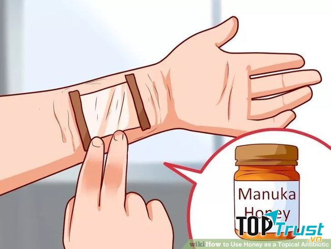 Chữa lành vết thương bằng mật ong