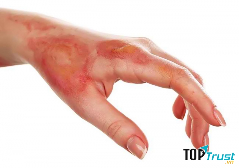 Ảnh minh họa - nguồn internet