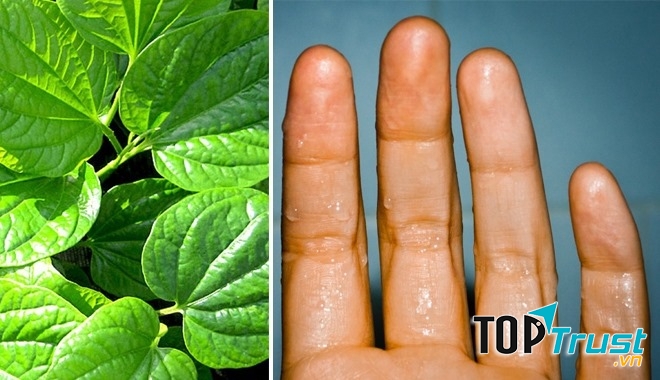 Chữa mồ hôi tay