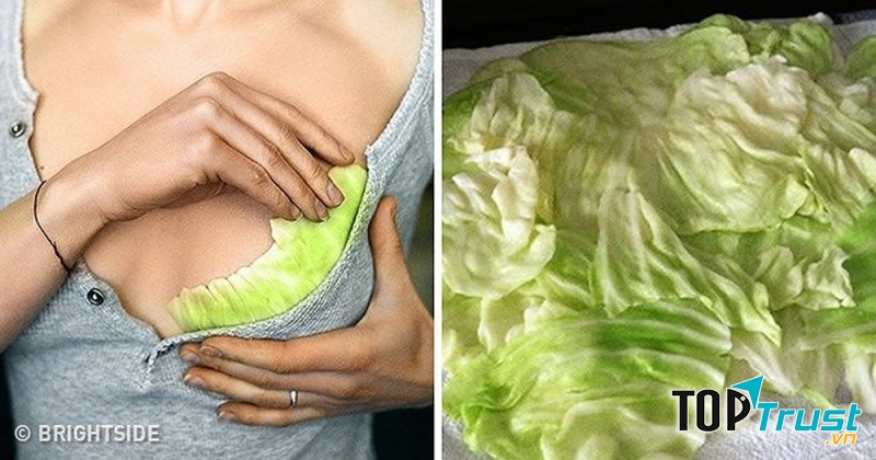 Chữa tắc tia sữa bằng lá bắp cải
