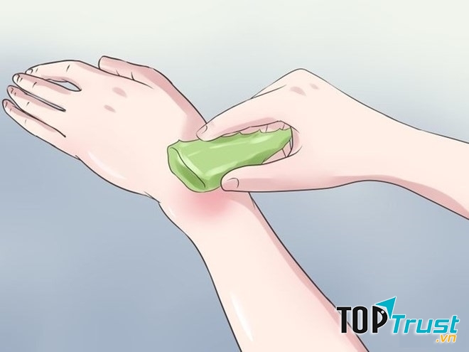 Đắp trực tiếp nha đam lên vết bỏng bạn sẽ thấy công hiệu của lá