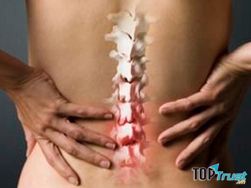 Chùm ngây giúp ngăn ngừa loãng xương