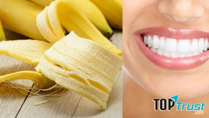 Một trong những bí kíp tẩy trắng răng hiệu quả tại nhà được nhiều người áp dụng chính là vỏ chuối.
