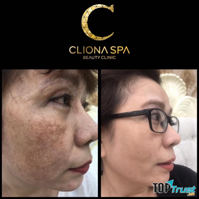 Cliona Spa