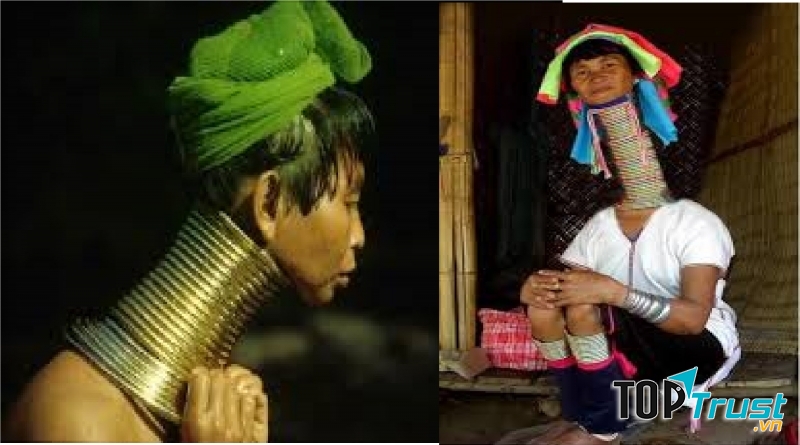 Cổ dài
