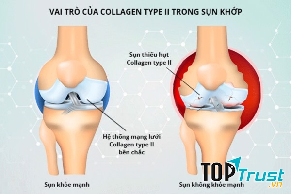 Collagen giúp xương chắc khỏe