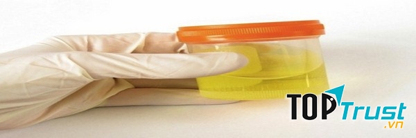 Kiểm tra chất gây nghiện