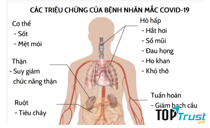 Các triệu trứng của bệnh nhân Covid-19