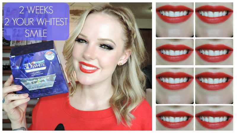 Crest 3D White Luxe Whitestrips Glamorous White Teeth Whitening Kit là sản phẩm làm trắng răng có xuất xứ từ Mỹ, có khả năng tẩy trắng răng đơn giản và vô cùng hiệu quả tại nhà.