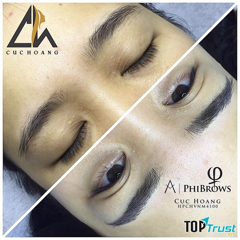 Cúc Hoàng Phun Thêu thẩm mỹ