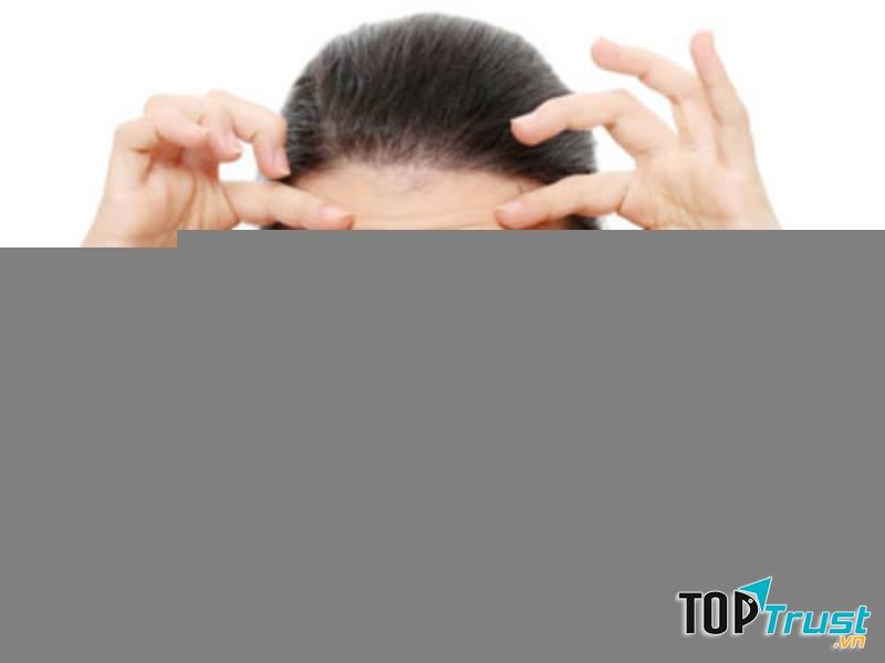 Da xuất hiện các nếp nhăn chính là dấu hiệu da đang bị lão hóa