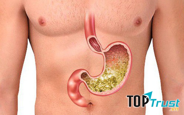 Dạ dày có thể hủy diệt cả sắt thép