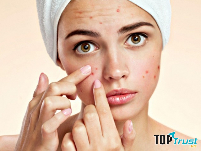 Rối loại về da có thể do cơ thể bị nhiễm độc hoặc bị stress