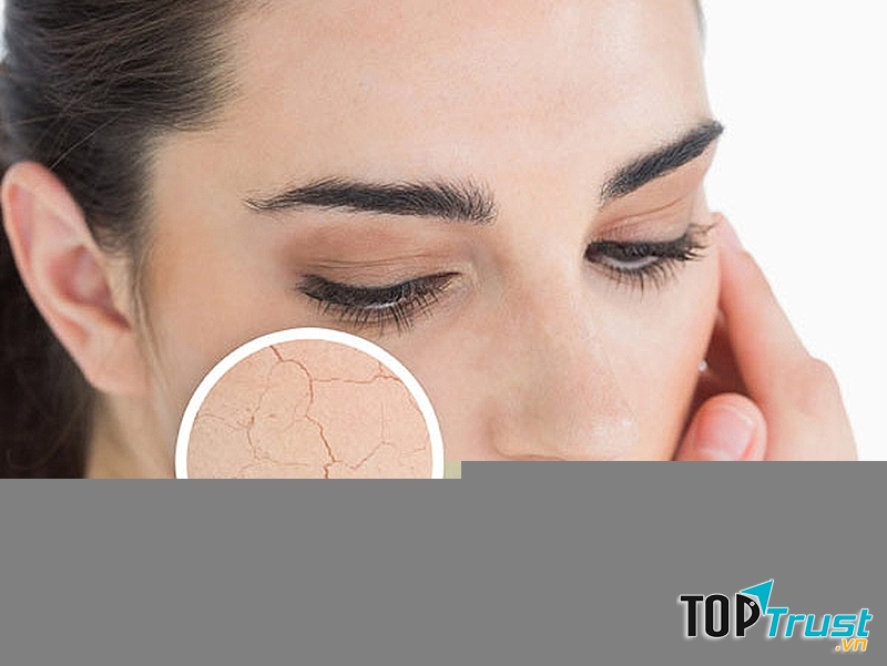Da khô giúp bạn biết được làn da của mình đang dần bị lão hóa