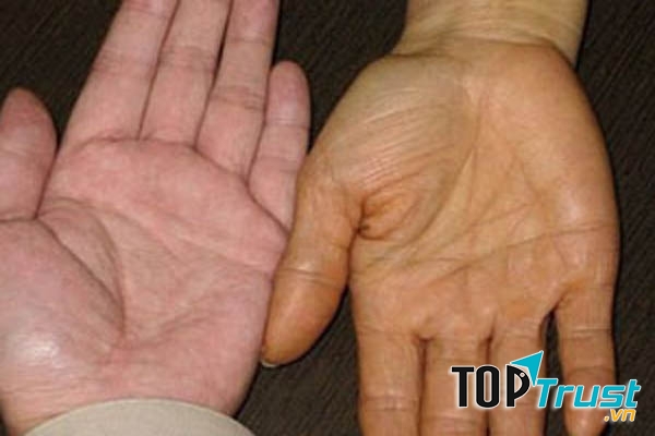 Da vàng bất thường