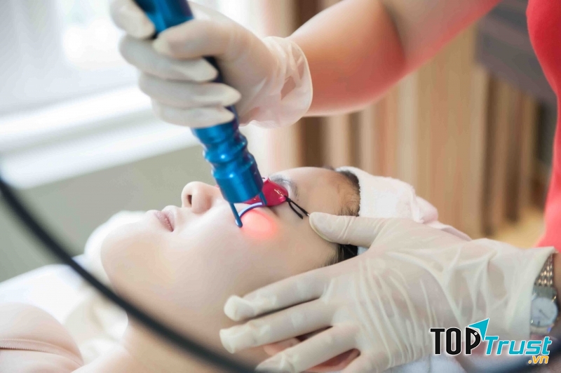 Trị nám da hiệu quả tại Dạ Yến Thảo spa