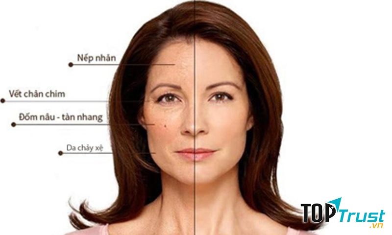 Kết quả xóa nhăn hiệu quả tại Dạ Yến Thảo Spa