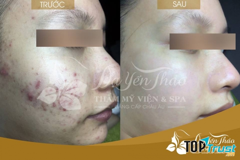 Dạ Yến Thảo spa