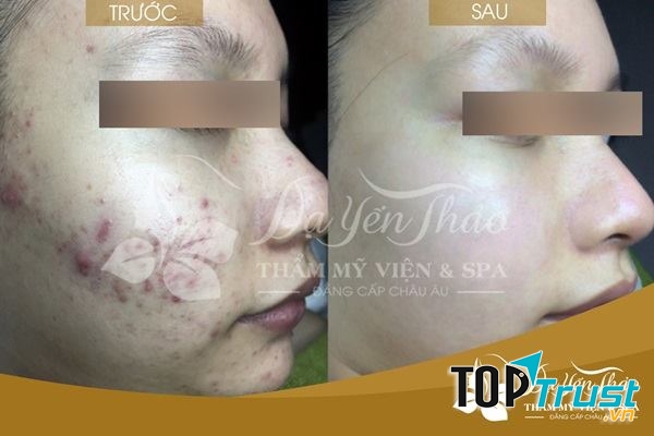 Dạ Yến Thảo Spa