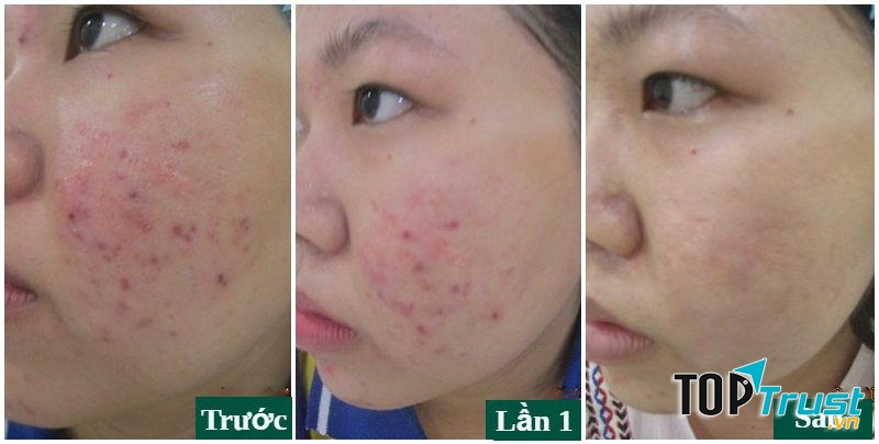 Dạ Yến Thảo Spa