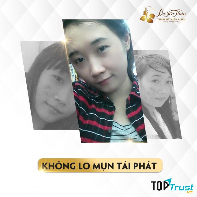 Dạ Yến Thảo Spa