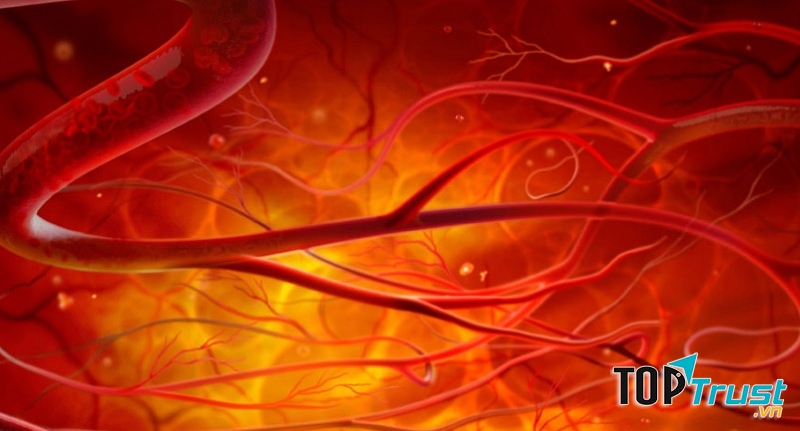 Đảm bảo sự khỏe mạnh cho hệ thống mạch máu