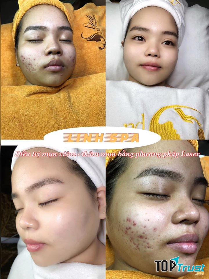 Dáng Đẹp, Sắc Xinh - Linh Spa