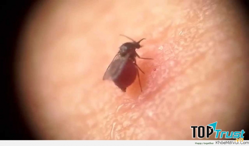 Dĩn có vòi ngắn nên thường tập trung vào những vùng không được che đậy bởi quần áo như mặt, mũi