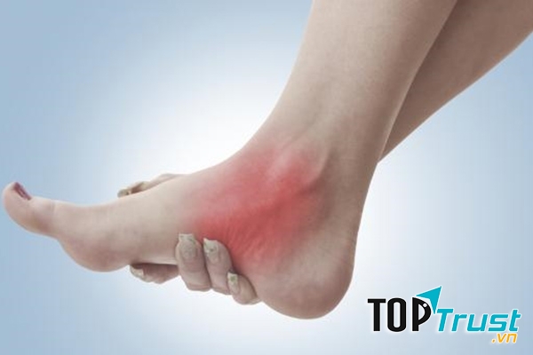 Chữa lành bong gân, trật khớp