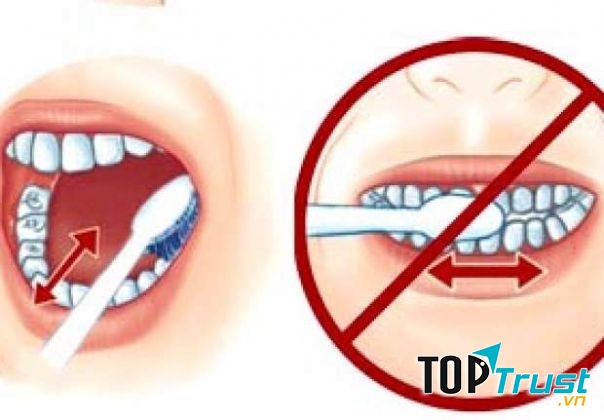 Đánh răng theo chiều ngang