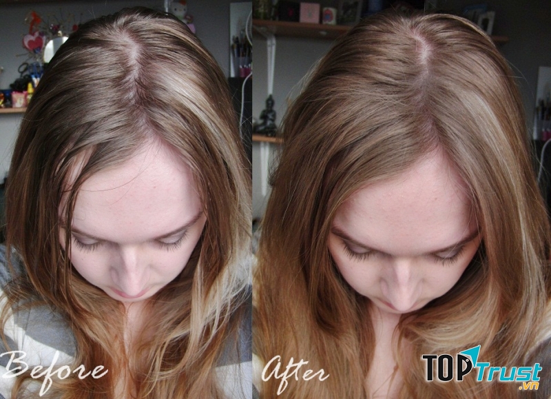 Dầu khô Dove này sẽ hút bớt bã nhờn, mùi mồ hôi trả lại sự ngát hương cho tóc của bạn.