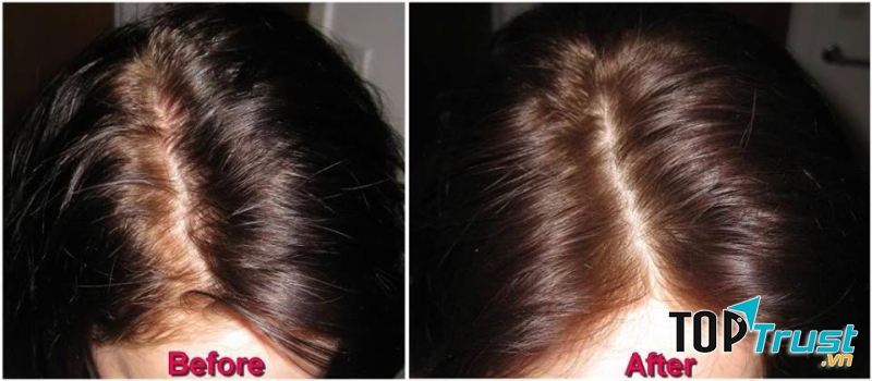 Dầu gội khô Oh My God Dry Shampoo - sản phẩm cứu nguy, chăm sóc cho mái tóc đang bị bếch dính và bóng nhờn trở nên sạch và nhẹ nhàng ngay tức thời.