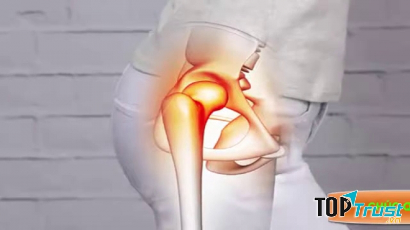 Đau khớp háng, xương mu cuối thai kì
