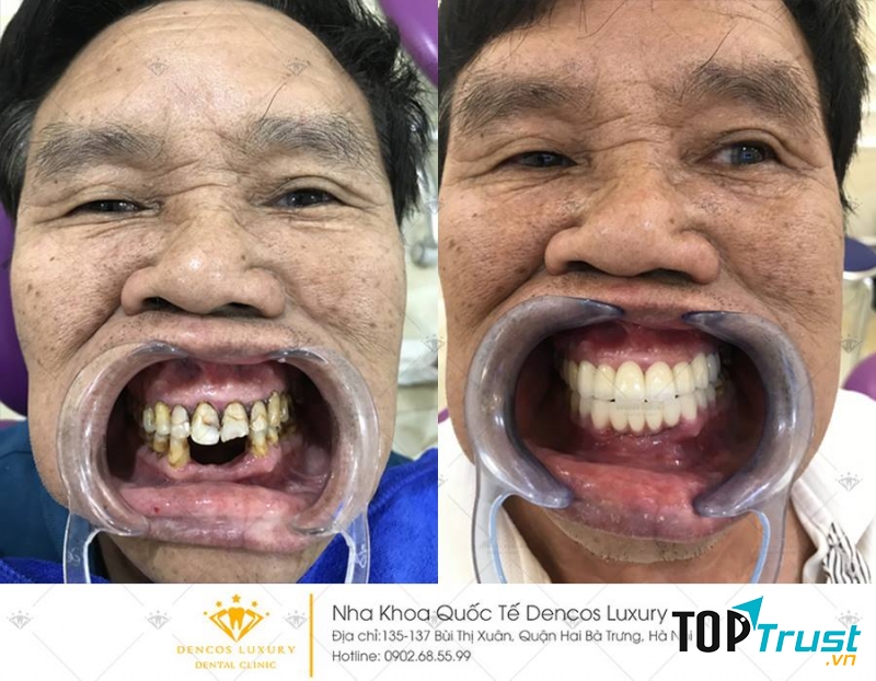 Dencos Luxury Thanh hóa