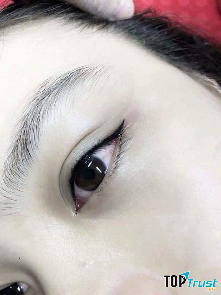 Spa Ly Trần