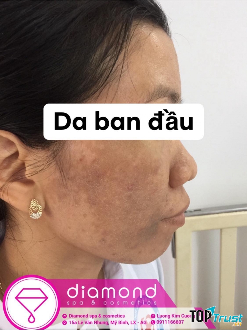 Diamond Spa & Cosmetics