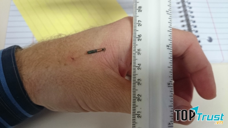 Điện thoại cấy ghép năm 2024