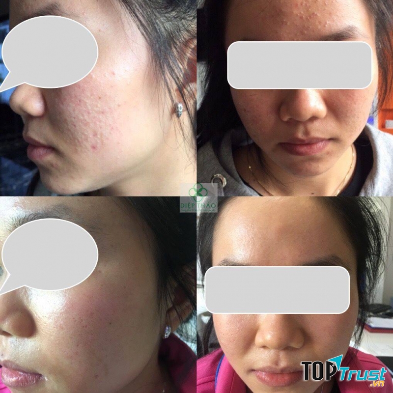DIỆP THẢO MEDI-SPA