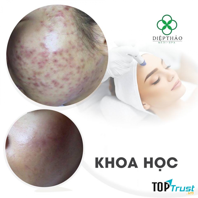 DIỆP THẢO MEDI-SPA