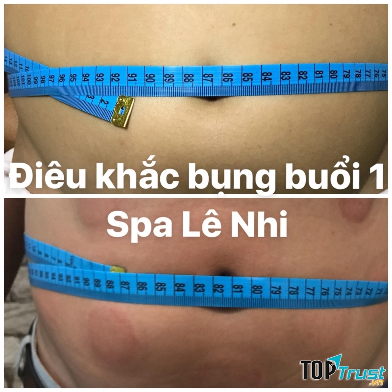 Điêu khắc bụng buổi 1 tại Spa Lê Nhi